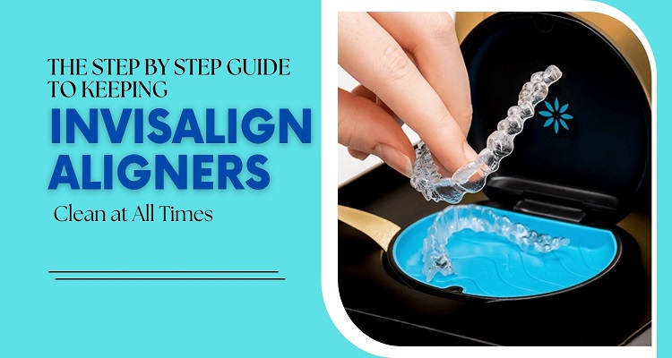 The Step by Step Guide to Keeping Invisalign Aligners Clean at All Times